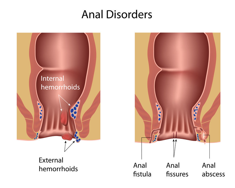 Best of Wrong hole anal