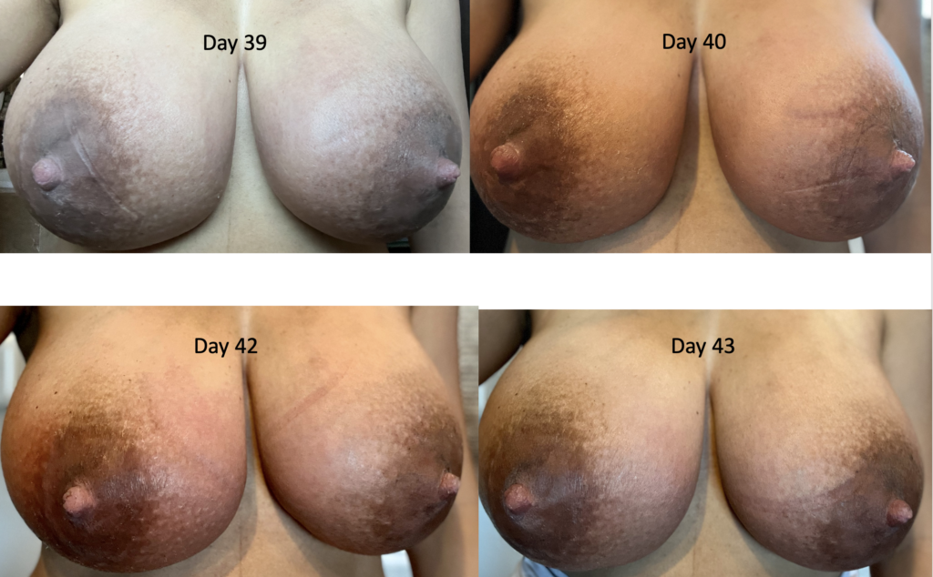 betty tolbert recommends bouncing breasts compilation pic