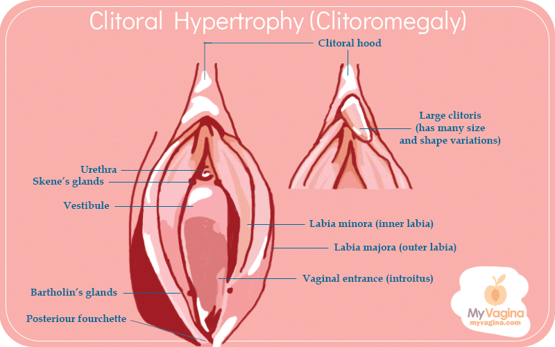 women with large clits