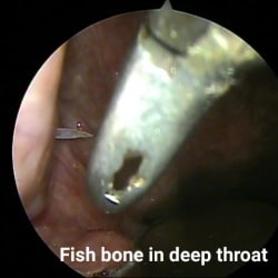 deep throat comp