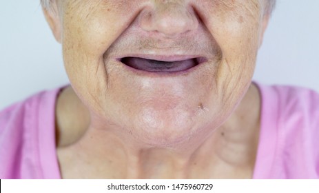 alice kersting recommends No Teeth Old Lady