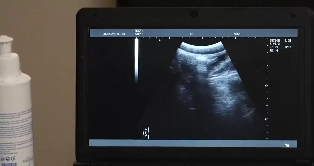 bob mcelrath recommends Porn Ultrasound