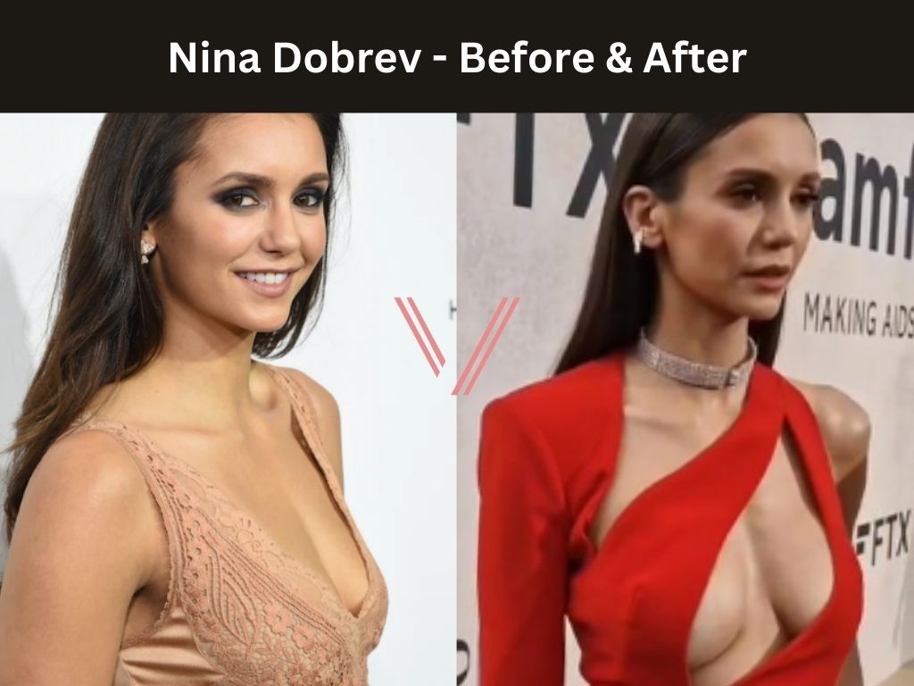 brooke mix add nina dobrev tits photo