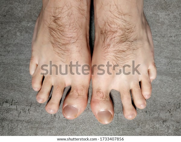 david e yates add hairy men feet photo