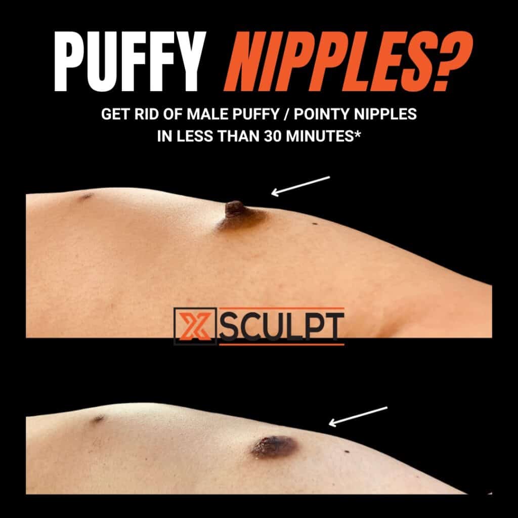 aruni fernando recommends puffy women nipple pic