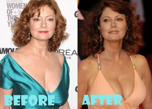 aaron froese recommends Susan Sarandon Breasts