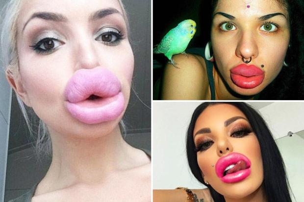 abdallah nour add big lips porn photo