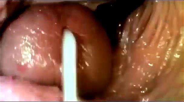 internal vagina camera