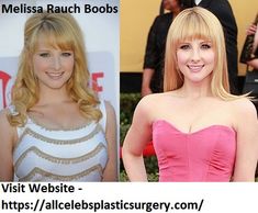 daniel uzcategui recommends Melissa Rauch Breast