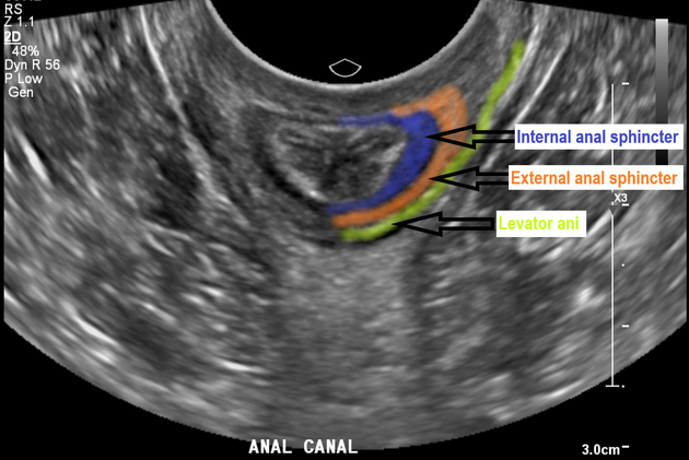 brian jurries recommends anal acident pic