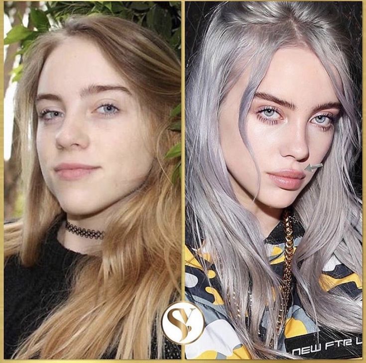 damien callinan recommends billie eilish boob job pic