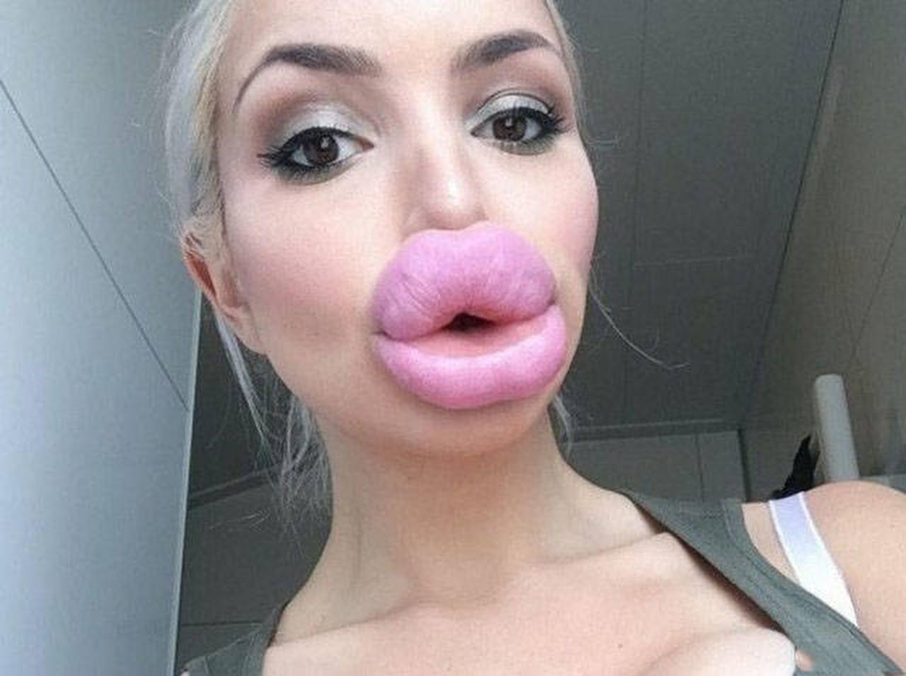 audrey louis recommends fake lips porn pic