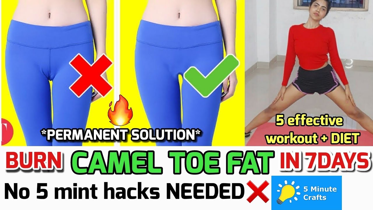 diseno grafico recommends Fattest Cameltoe