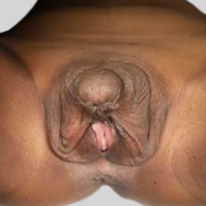 alfara recommends large clitoris photos pic