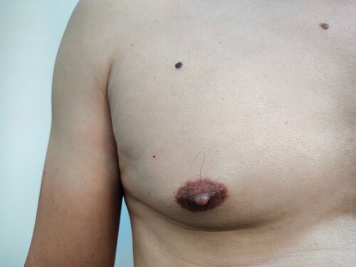 aaron brick add little puffy titties photo