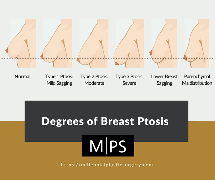 bikash ale recommends naturally perky tits pic