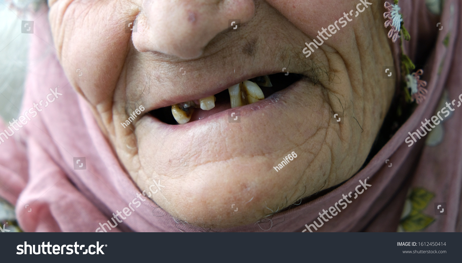 no teeth old lady