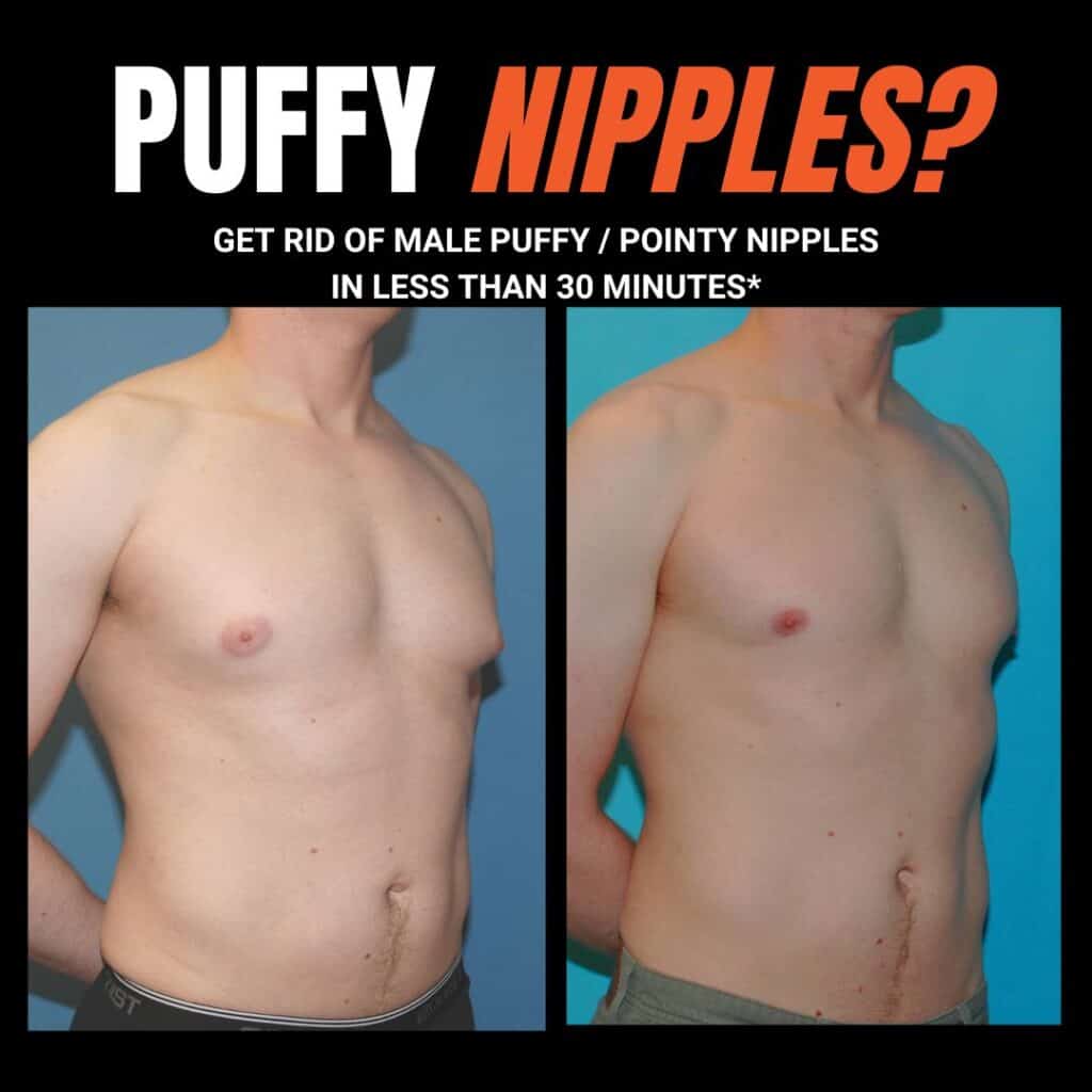 christa maritz recommends Puffy Women Nipple