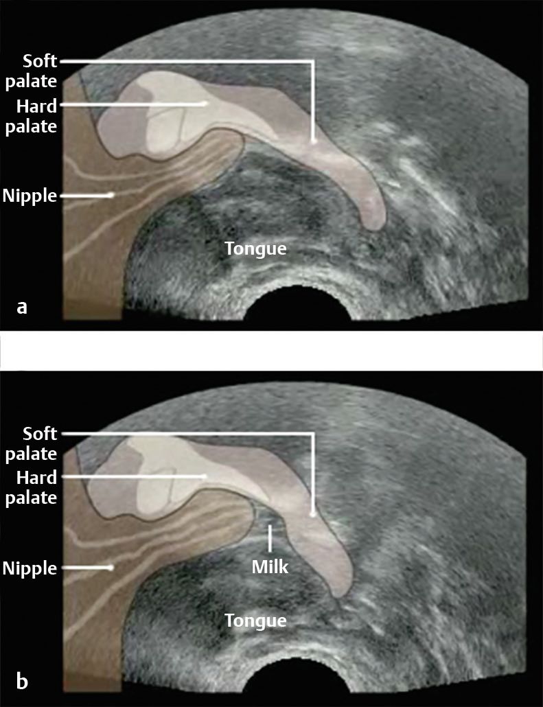 amber damm recommends sucking lactating breasts pic